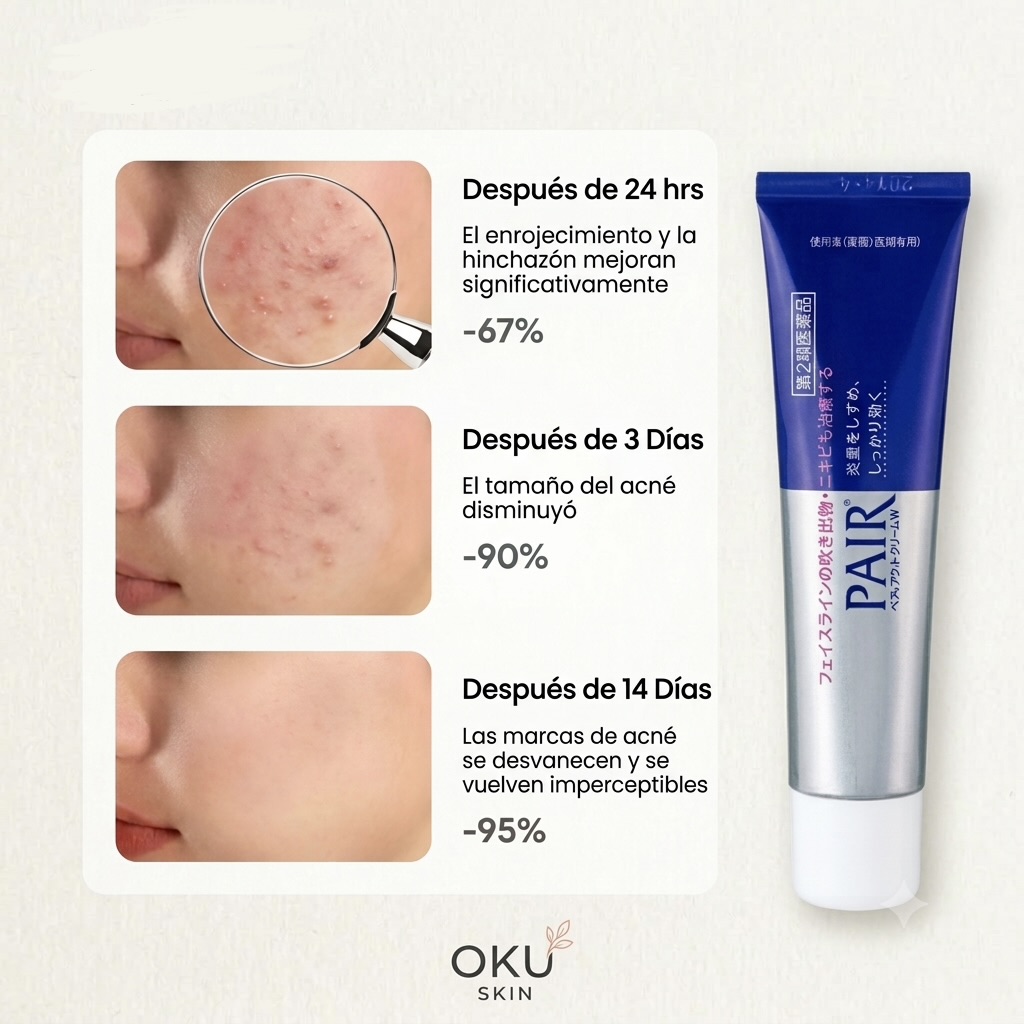 Crema Antiacné Pair Acne Cream W